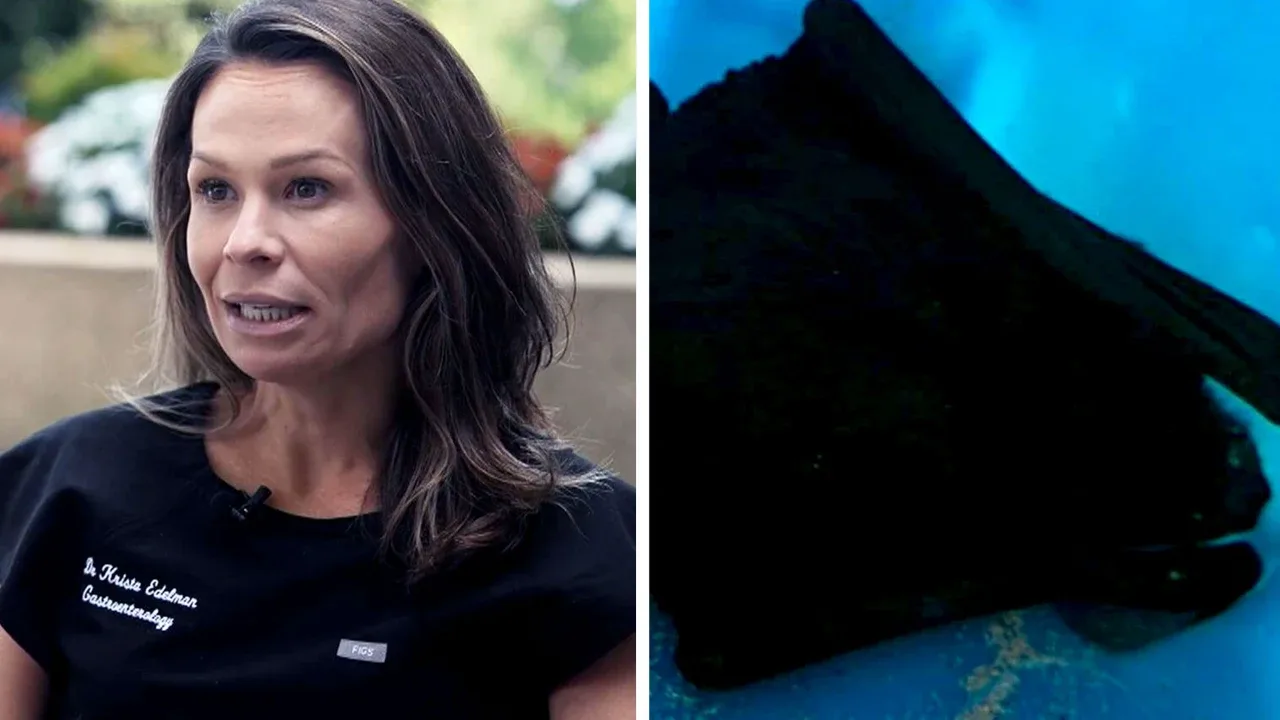 A bat tried to enter a woman's mouth — what are doctors warning about?
