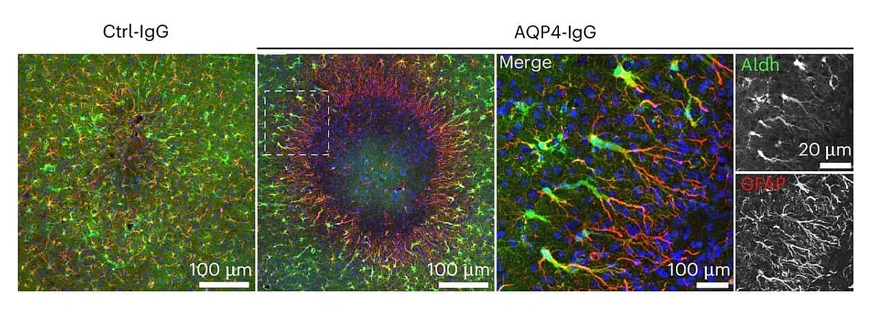 Neurobiologists Discover a New Mechanism for Brain Tissue Repair
