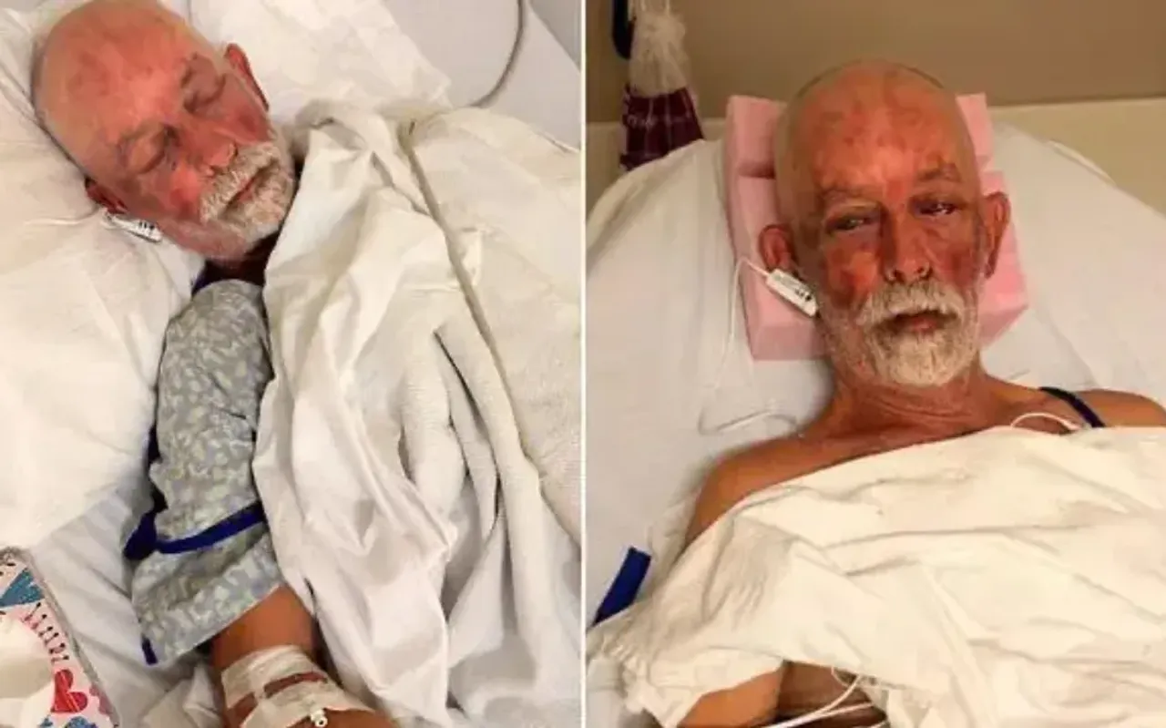 Man pressed along with garbage survives in the USA