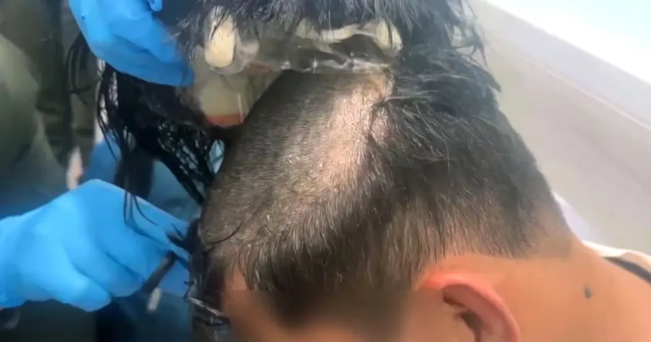 Man arrested in Colombia for hiding 220 grams of cocaine under a wig (video)