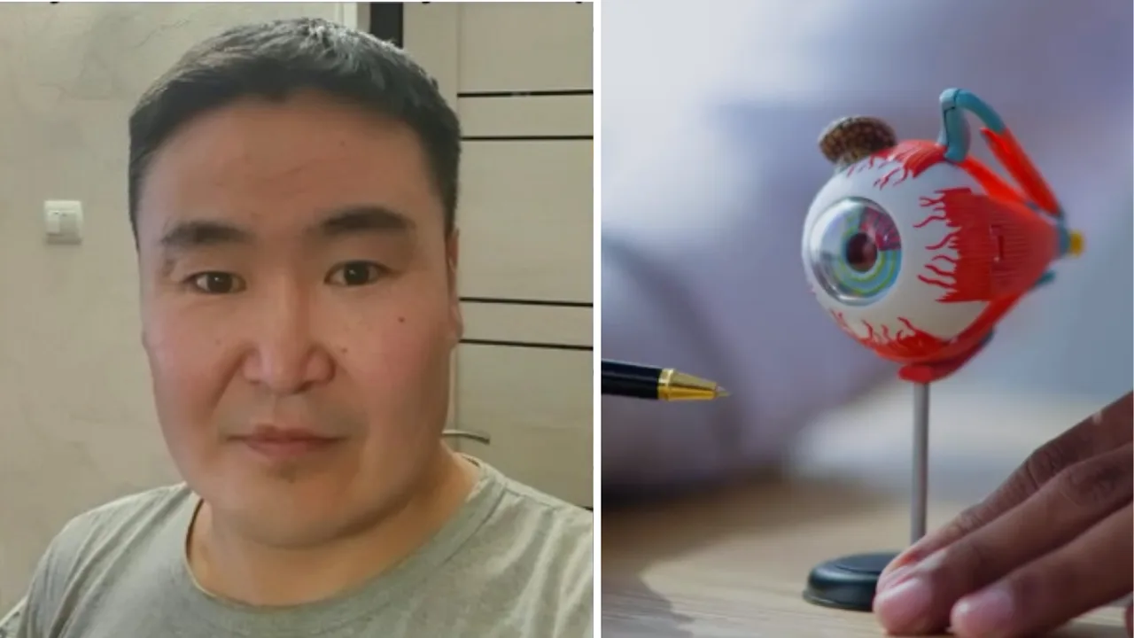 Plant seed sprouts in a man's eye tissue in Russia